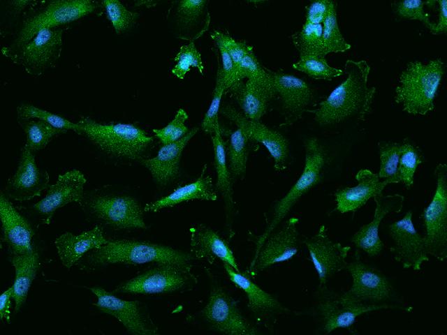 PYGL Antibody - Immunofluorescence staining of PYGL in U251MG cells. Cells were fixed with 4% PFA, permeabilzed with 0.1% Triton X-100 in PBS, blocked with 10% serum, and incubated with rabbit anti-Human PYGL polyclonal antibody (dilution ratio 1:200) at 4°C overnight. Then cells were stained with the Alexa Fluor 488-conjugated Goat Anti-rabbit IgG secondary antibody (green) and counterstained with DAPI (blue). Positive staining was localized to Cytoplasm and cell membrane.