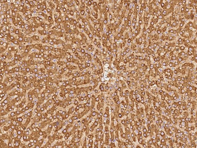 PYGL Antibody - Immunochemical staining of human PYGL in human liver with rabbit polyclonal antibody at 1:300 dilution, formalin-fixed paraffin embedded sections.