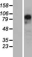 PYGL Protein - Western validation with an anti-DDK antibody * L: Control HEK293 lysate R: Over-expression lysate