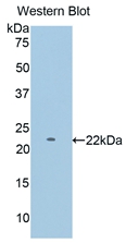 PYGM Antibody - Western Blot; Sample: Recombinant protein.