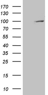 PYGM Antibody - HEK293T cells were transfected with the pCMV6-ENTRY control. (Left lane) or pCMV6-ENTRY PYGM. (Right lane) cDNA for 48 hrs and lysed. Equivalent amounts of cell lysates. (5 ug per lane) were separated by SDS-PAGE and immunoblotted with anti-PYGM. (1:2000)