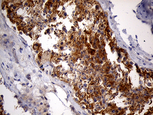 PYGM Antibody - Immunohistochemical staining of paraffin-embedded Human testicle tissue within the normal limits using anti-PYGM mouse monoclonal antibody. (Heat-induced epitope retrieval by 1mM EDTA in 10mM Tris buffer. (pH8.5) at 120°C for 3 min. (1:2000)