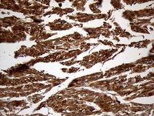 PYGM Antibody - Immunohistochemical staining of paraffin-embedded Human adult heart tissue within the normal limits using anti-PYGM mouse monoclonal antibody. (Heat-induced epitope retrieval by 1mM EDTA in 10mM Tris buffer. (pH8.5) at 120 oC for 3 min. (1:2000)