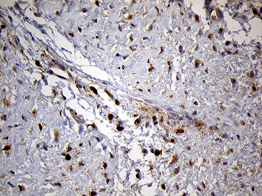 PYGM Antibody - Immunohistochemical staining of paraffin-embedded Human muscle tissue within the normal limits using anti-PYGM mouse monoclonal antibody. (Heat-induced epitope retrieval by 1mM EDTA in 10mM Tris buffer. (pH8.5) at 120 oC for 3 min. (1:2000)