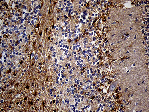 PYGM Antibody - Immunohistochemical staining of paraffin-embedded Human embryonic cerebellum within the normal limits using anti-PYGM mouse monoclonal antibody. (Heat-induced epitope retrieval by 1mM EDTA in 10mM Tris buffer. (pH8.5) at 120°C for 3 min. (1:2000)