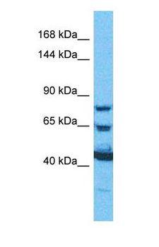 PYGM Antibody - Western blot of PYGM Antibody with human HeLa Whole Cell lysate.  This image was taken for the unconjugated form of this product. Other forms have not been tested.