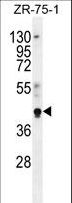 PYGO1 / Pygopus 1 Antibody - PYGO1 Antibody western blot of ZR-75-1 cell line lysates (35 ug/lane). The PYGO1 antibody detected the PYGO1 protein (arrow).