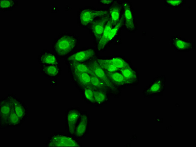 PYGO2 / Pygopus 2 Antibody - Immunofluorescence staining of HepG2 cells at a dilution of 1:100, counter-stained with DAPI. The cells were fixed in 4% formaldehyde, permeabilized using 0.2% Triton X-100 and blocked in 10% normal Goat Serum. The cells were then incubated with the antibody overnight at 4 °C.The secondary antibody was Alexa Fluor 488-congugated AffiniPure Goat Anti-Rabbit IgG (H+L) .