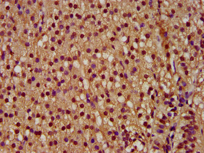 PYGO2 / Pygopus 2 Antibody - Immunohistochemistry image at a dilution of 1:300 and staining in paraffin-embedded human adrenal gland tissue performed on a Leica BondTM system. After dewaxing and hydration, antigen retrieval was mediated by high pressure in a citrate buffer (pH 6.0) . Section was blocked with 10% normal goat serum 30min at RT. Then primary antibody (1% BSA) was incubated at 4 °C overnight. The primary is detected by a biotinylated secondary antibody and visualized using an HRP conjugated SP system.