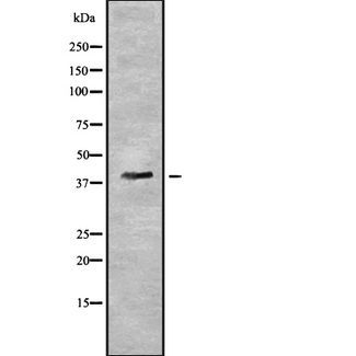PYGO2 / Pygopus 2 Antibody - Western blot analysis of PYGO2 using HuvEc whole cells lysates