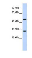 PYGO2 / Pygopus 2 Antibody - PYGO2 / Pygopus 2 antibody Western blot of HeLa lysate. This image was taken for the unconjugated form of this product. Other forms have not been tested.