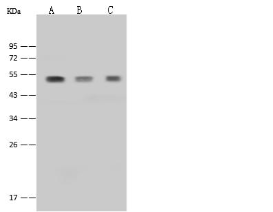 PYGO2 / Pygopus 2 Antibody - Anti-PYGO2 rabbit polyclonal antibody at 1:500 dilution. Lane A: MCF7 Whole Cell Lysate. Lane B: HeLa Whole Cell Lysate. Lane C: 293T Whole Cell Lysate. Lysates/proteins at 30 ug per lane. Secondary: Goat Anti-Rabbit IgG (H+L)/HRP at 1/10000 dilution. Developed using the ECL technique. Performed under reducing conditions. Predicted band size: 41 kDa. Observed band size: 50 kDa.