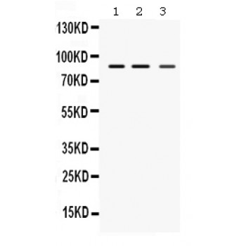 Pyrin / MEFV / MEF Antibody - MEFV antibody Western blot. All lanes: Anti MEFV at 0.5 ug/ml. Lane 1: Rat Spleen Tissue Lysate at 50 ug. Lane 2: Rat Lung Tissue Lysate at 50 ug. Lane 3: HEPA Whole Cell Lysate at 40 ug. Predicted band size: 86 kD. Observed band size: 86 kD.