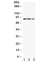 Pyrin / MEFV / MEF Antibody