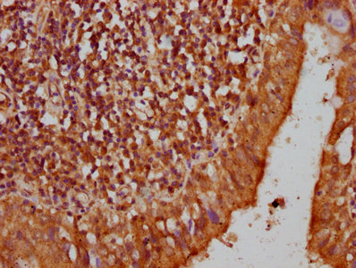Pyrin / MEFV / MEF Antibody - Immunohistochemistry Dilution at 1:200 and staining in paraffin-embedded human lung tissue performed on a Leica BondTM system. After dewaxing and hydration, antigen retrieval was mediated by high pressure in a citrate buffer (pH 6.0). Section was blocked with 10% normal Goat serum 30min at RT. Then primary antibody (1% BSA) was incubated at 4°C overnight. The primary is detected by a biotinylated Secondary antibody and visualized using an HRP conjugated SP system.