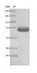 Putative L-asparaginase Protein - (Tris-Glycine gel) Discontinuous SDS-PAGE (reduced) with 5% enrichment gel and 15% separation gel.