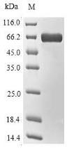 Tr:g608530 G608530 L-aspartate Oxidase. ;  Protein - (Tris-Glycine gel) Discontinuous SDS-PAGE (reduced) with 5% enrichment gel and 15% separation gel.