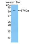 PZP Antibody - Western blot of recombinant PZP.  This image was taken for the unconjugated form of this product. Other forms have not been tested.