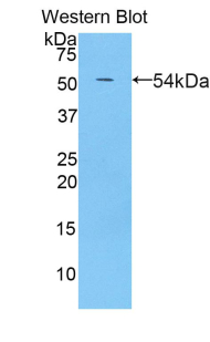PZP Antibody - Western blot of recombinant PZP.  This image was taken for the unconjugated form of this product. Other forms have not been tested.