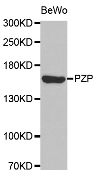 PZP Antibody - Western blot analysis of extracts of BeWo cell line, using PZP antibody.