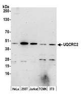 QCR2 / UQCRC2 Antibody - Detection of human and mouse UQCRC2 by western blot. Samples: Whole cell lysate (15 µg) from HeLa, HEK293T, Jurkat, mouse TCMK-1, and mouse NIH 3T3 cells prepared using NETN lysis buffer. Antibody: Affinity purified rabbit anti-UQCRC2 antibody used for WB at 0.1 µg/ml. Detection: Chemiluminescence with an exposure time of 3 minutes.