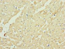 QCR2 / UQCRC2 Antibody - Immunohistochemistry of paraffin-embedded human heart tissue at dilution of 1:100