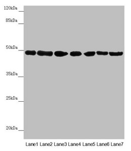 QCR2 / UQCRC2 Antibody - Western blot All Lanes:UQCRC2 antibody at 2.95 ug/ml Lane 1: Human placenta tissue Lane 2: Mouse large intestine tissue Lane 3: Mouse small intestine tissue Lane 4: Mouse brain tissue Lane 5: HepG-2 whole cell lysate Lane 6: Jurkat whole cell lysate Lane 7: 293T whole cell lysate Secondary Goat polyclonal to rabbit IgG at 1/10000 dilution Predicted band size: 48 kDa Observed band size: 48 kDa