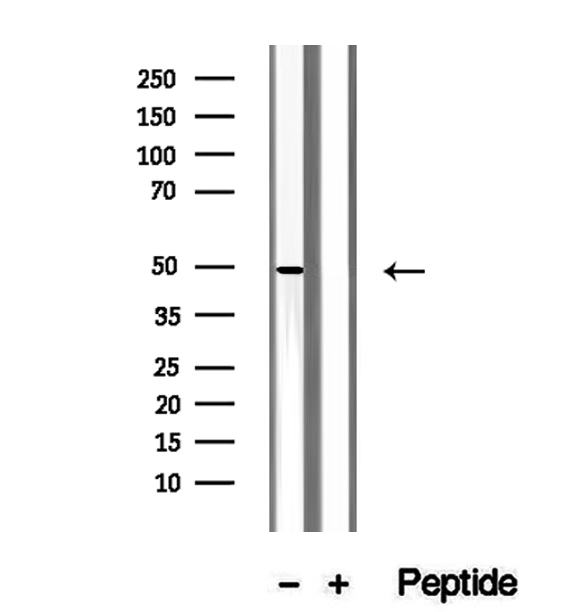 QCR2 / UQCRC2 Antibody - Western blot analysis of extracts of SGC-7901 cells using UQCRC2 antibody.