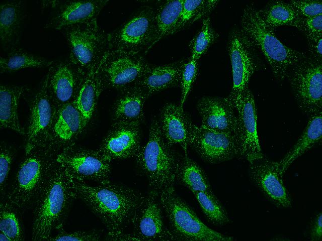 QCR2 / UQCRC2 Antibody - Immunofluorescence staining of UQCRC2 in U2OS cells. Cells were fixed with 4% PFA, permeabilzed with 0.1% Triton X-100 in PBS, blocked with 10% serum, and incubated with rabbit anti-Human UQCRC2 polyclonal antibody (dilution ratio 1:100) at 4°C overnight. Then cells were stained with the Alexa Fluor 488-conjugated Goat Anti-rabbit IgG secondary antibody (green) and counterstained with DAPI (blue). Positive staining was localized to Cytoplasm.
