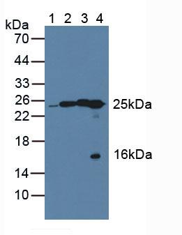 QDPR / DHPR Antibody - Western Blot; Lane1: Human HepG2 Cells; Lane2: Porcine Liver Tissue; Lane3: Porcine Brain Tissue; Lane4: Rat Liver Tissue.
