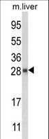 QDPR / DHPR Antibody - Western blot of QDPR Antibody in mouse liver tissue lysates (35 ug/lane). QDPR (arrow) was detected using the purified antibody.