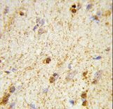 QDPR / DHPR Antibody - Formalin-fixed and paraffin-embedded human brain tissue reacted with QDPR Antibody , which was peroxidase-conjugated to the secondary antibody, followed by DAB staining. This data demonstrates the use of this antibody for immunohistochemistry; clinical relevance has not been evaluated.