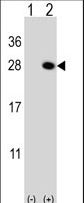 QDPR / DHPR Antibody - Western blot of QDPR (arrow) using rabbit polyclonal QDPR Antibody. 293 cell lysates (2 ug/lane) either nontransfected (Lane 1) or transiently transfected (Lane 2) with the QDPR gene.
