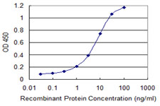 QDPR / DHPR Antibody - Detection limit for recombinant GST tagged QDPR is 0.1 ng/ml as a capture antibody.