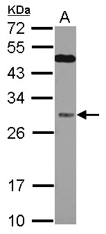 QDPR / DHPR Antibody - Sample (30 ug of whole cell lysate) A: Jurkat 12% SDS PAGE QDPR antibody diluted at 1:1000
