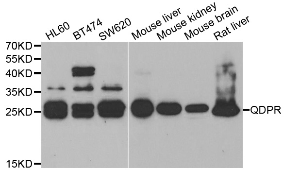 QDPR / DHPR Antibody - Western blot analysis of extracts of various cell lines.