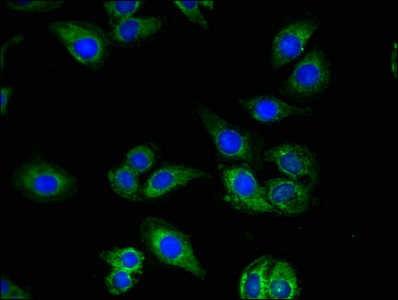 QDPR / DHPR Antibody - Immunofluorescent analysis of A549 cells using QDPR Antibody at dilution of 1:100 and Alexa Fluor 488-congugated AffiniPure Goat Anti-Rabbit IgG(H+L)