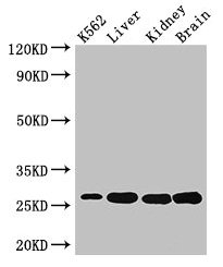 QDPR / DHPR Antibody - Western Blot Positive WB detected in: K562 whole cell lysate, Mouse liver tissue, Mouse lung tissue, Mouse kidney tissue, Mouse brain tissue All lanes: QDPR antibody at 3µg/ml Secondary Goat polyclonal to rabbit IgG at 1/50000 dilution Predicted band size: 26, 23 kDa Observed band size: 26 kDa