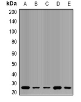 QDPR / DHPR Antibody - Western blot analysis of QDPR expression in HL60 (A); SW620 (B); mouse liver (C); mouse brain (D); rat liver (E) whole cell lysates.