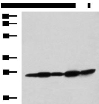 QDPR / DHPR Antibody - Western blot analysis of Mouse liver tissue Mouse brain tissue Rat brain tissue Rat liver tissue and Human fetal liver tissue lysates  using QDPR Polyclonal Antibody at dilution of 1:800