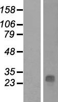 QDPR / DHPR Protein - Western validation with an anti-DDK antibody * L: Control HEK293 lysate R: Over-expression lysate