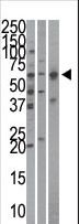 QIP1 / KPNA4 Antibody - The anti-Importin alpha-3 antibody is used in Western blot to detect Importin alpha-3 in HeLa (left), mouse brain (middle), and HepG2 (right)cell line/tissue lysates.