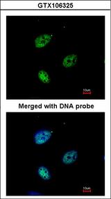 QIP1 / KPNA4 Antibody - Immunofluorescence of paraformaldehyde-fixed HeLa using QIP1 antibody at 1:200 dilution.