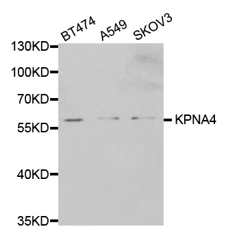 QIP1 / KPNA4 Antibody - Western blot analysis of extracts of various cell lines.