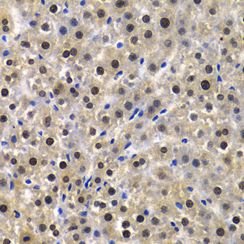 QIP1 / KPNA4 Antibody - Immunohistochemistry of paraffin-embedded Rat liver tissue.