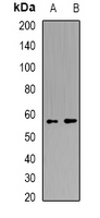 QIP1 / KPNA4 Antibody - Western blot analysis of Karyopherin alpha-4 expression in A549 (A); SKOV3 (B) whole cell lysates.