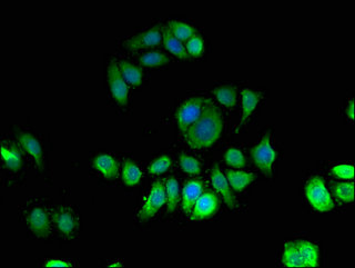 QIP1 / KPNA4 Antibody - Immunofluorescent analysis of PC3 cells using KPNA4 Antibody at a dilution of 1:100 and Alexa Fluor 488-congugated AffiniPure Goat Anti-Rabbit IgG(H+L)