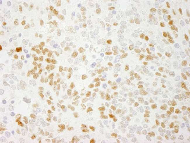 QKI Antibody - Detection of Mouse QKI by Immunohistochemistry. Sample: FFPE section of mouse teratoma. Antibody: Affinity purified rabbit anti-QKI used at a dilution of 1:250. Epitope Retrieval Buffer-High pH (IHC-101J) was substituted for Epitope Retrieval Buffer-Reduced pH.