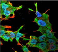 QKI Antibody - Detection of QKI-5 in neuroblastoma cell line SK-N-BE with Pan-QKI Monoclonal Antibody at 10ug/ml: DAPI (blue) nuclear stain, Texas Red F actin stain, ATTO 488 (green) QKI-5 stain.