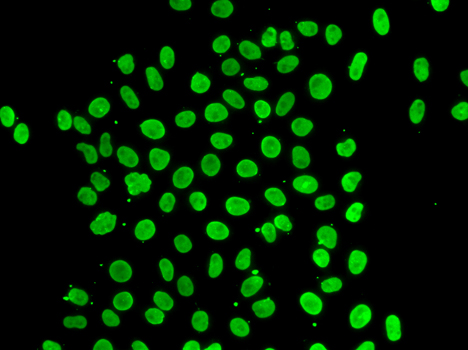 QKI Antibody - Immunofluorescence analysis of MCF7 cells.